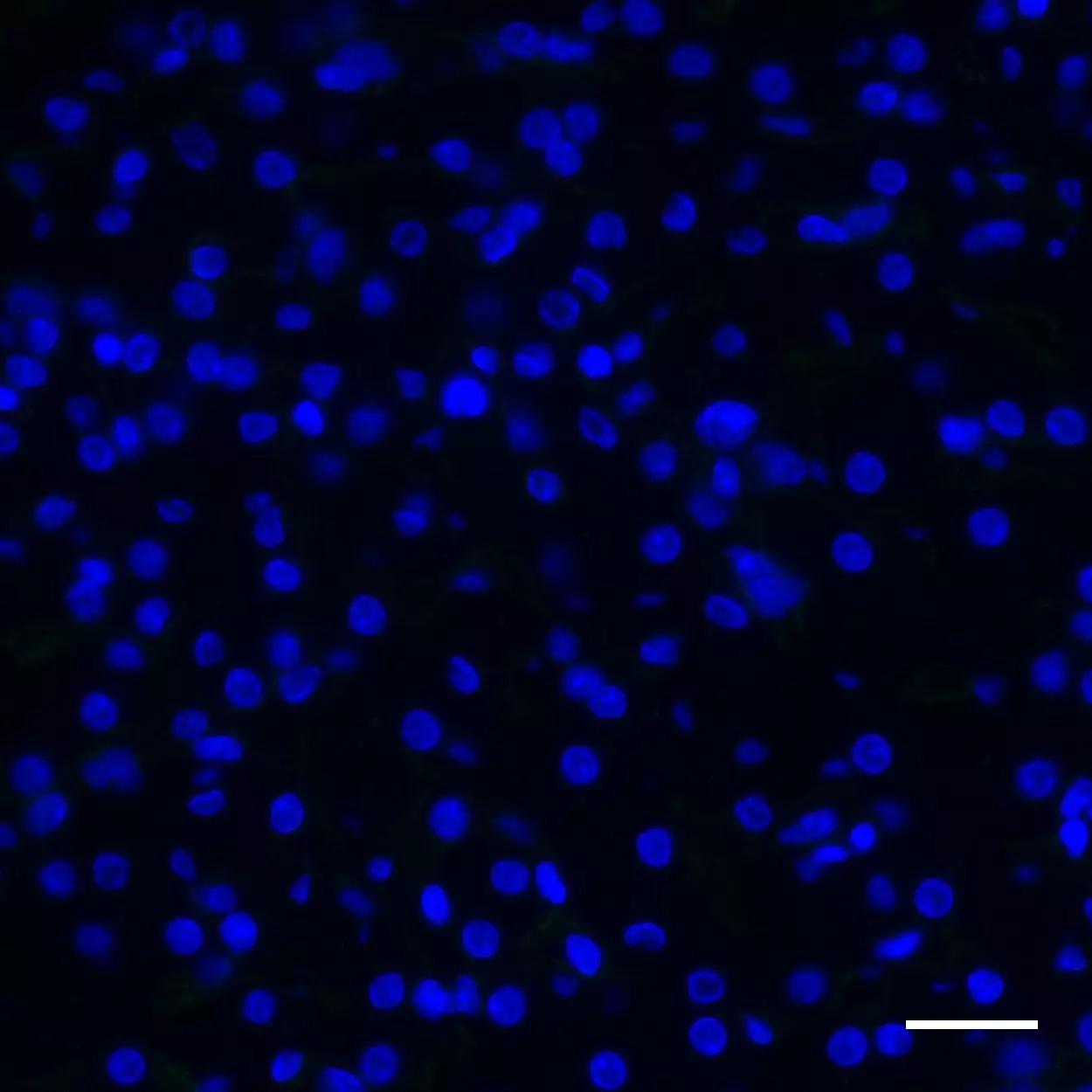 Collagen IV Antibody Anti Human REAdye Lease Releasable