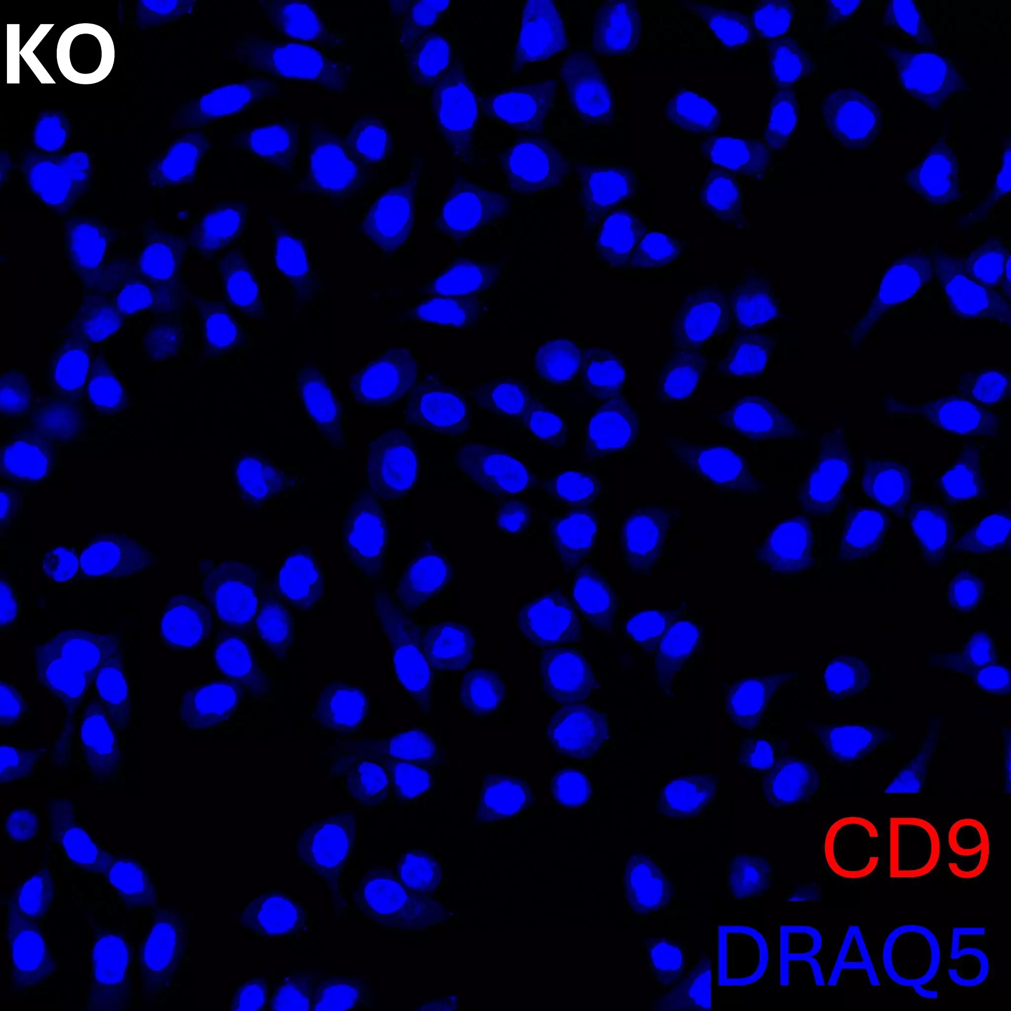 CD9 Antibody, anti-human, REAfinity™ | Miltenyi Biotec | USA
