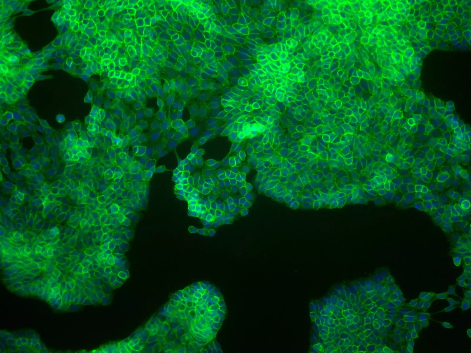 Tumor Cell Isolation Kit, human Miltenyi Biotec USA