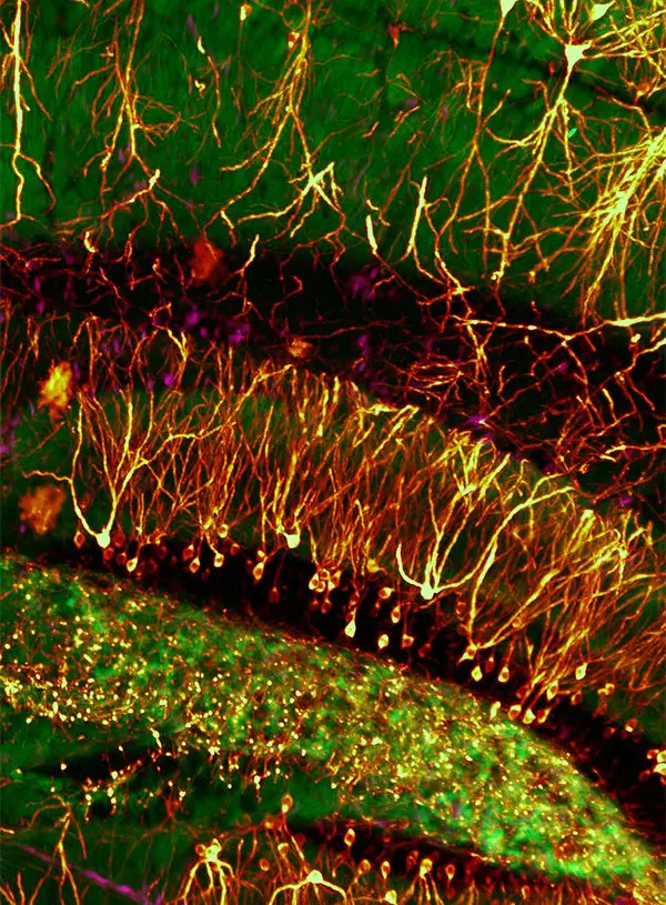 UltraMicroscope Blaze™ | Miltenyi Biotec | USA