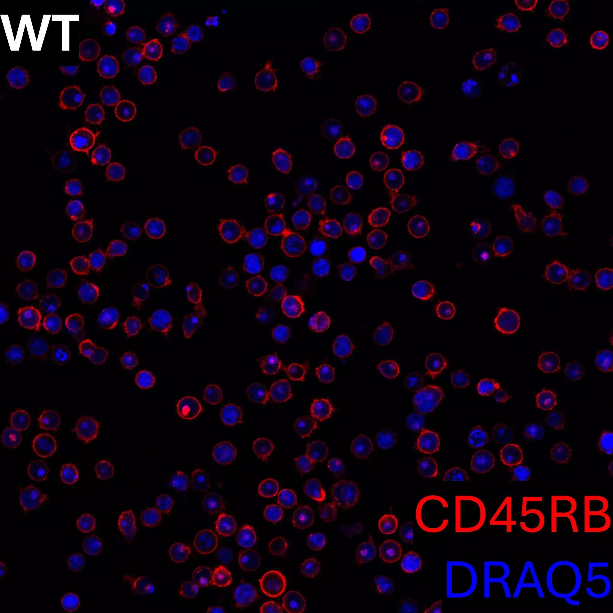 CD45RB Antibody, anti-human, REAfinity™ | Miltenyi Biotec | 中国