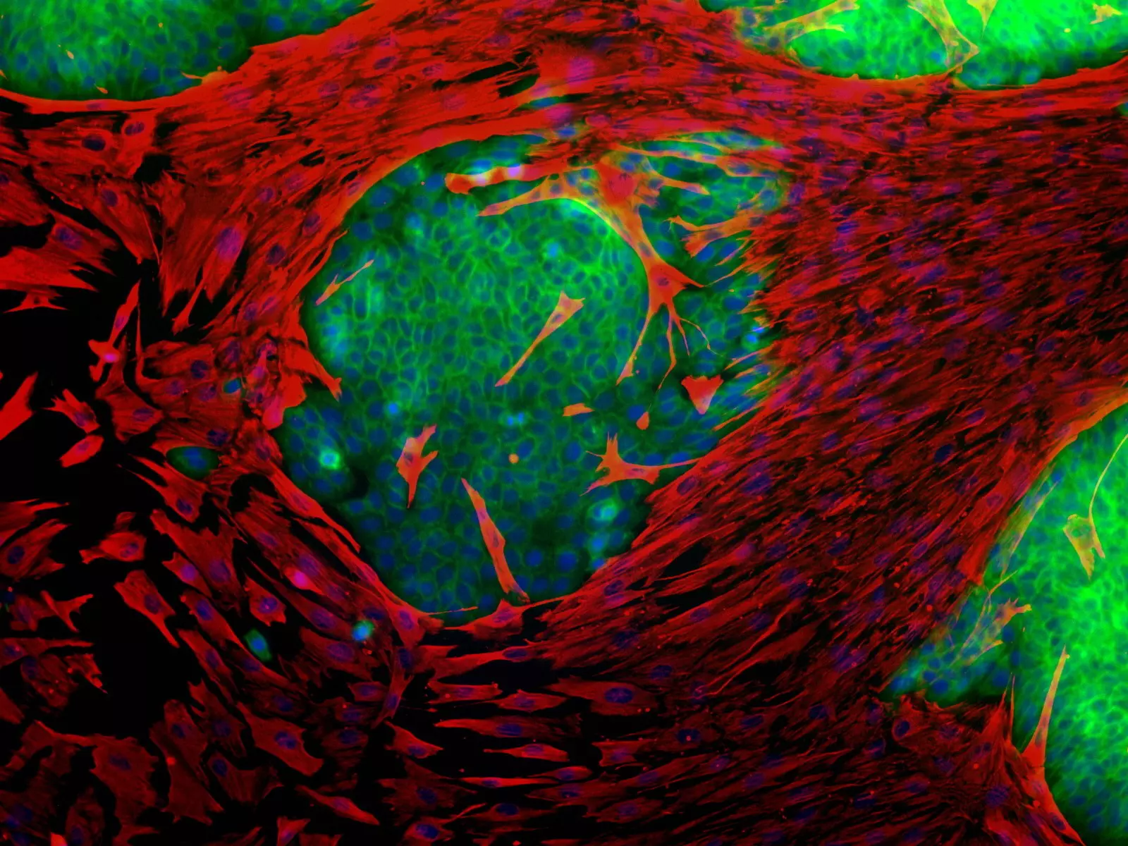 Tumor Cell Isolation Kit, human | Miltenyi Biotec | USA