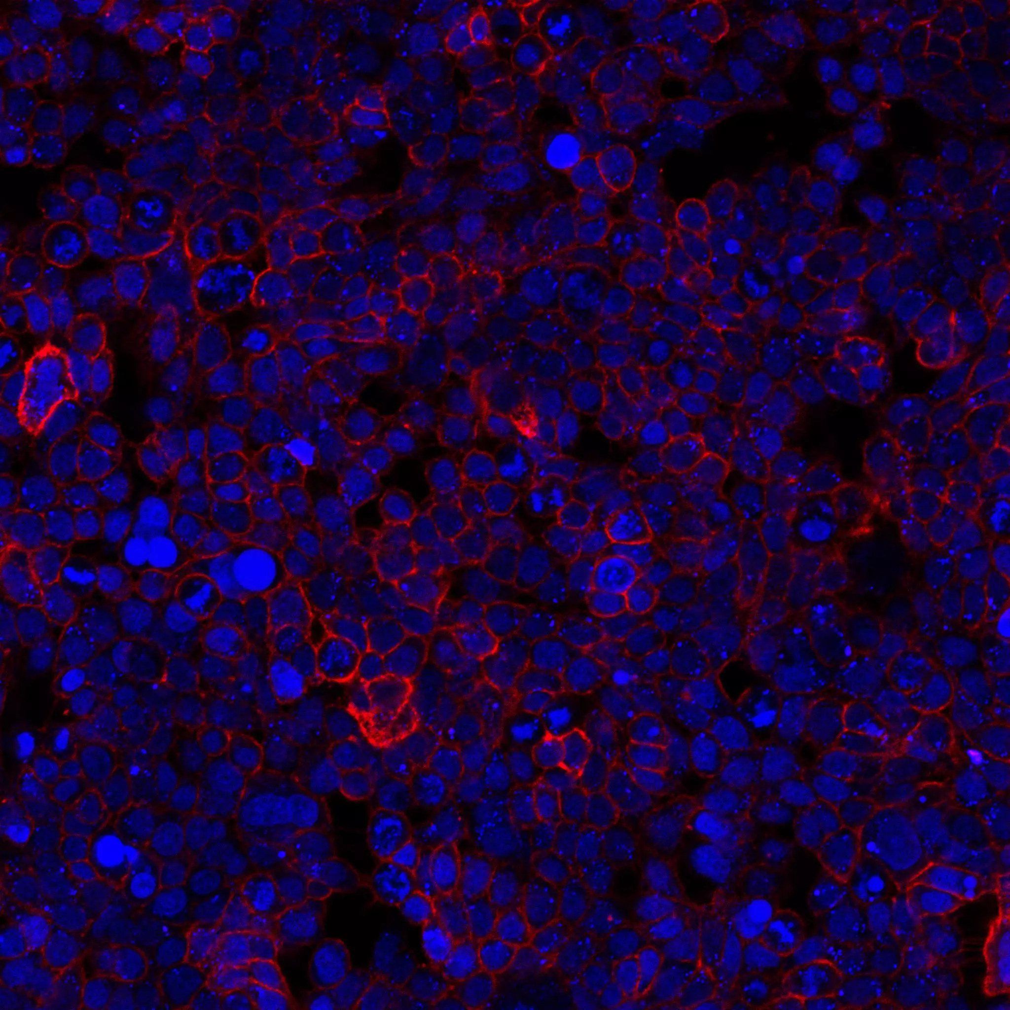 TM4SF1 Antibody, anti-human, REAfinity™ | Miltenyi Biotec | USA