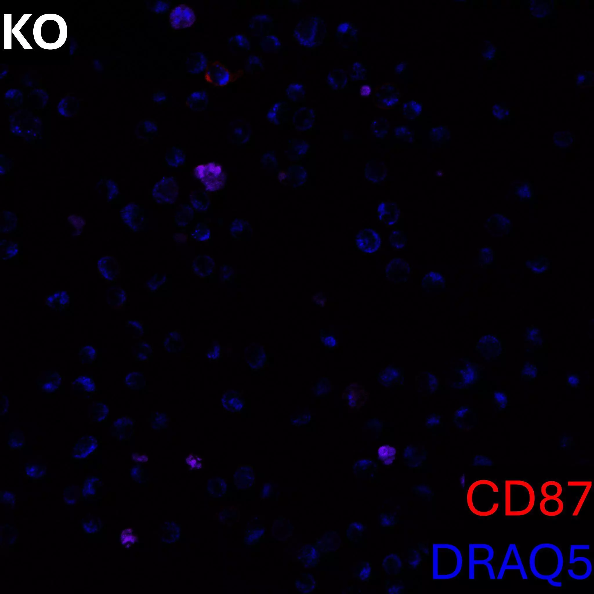 CD87 Antibody, anti-human, REAfinity™ | Miltenyi Biotec | USA