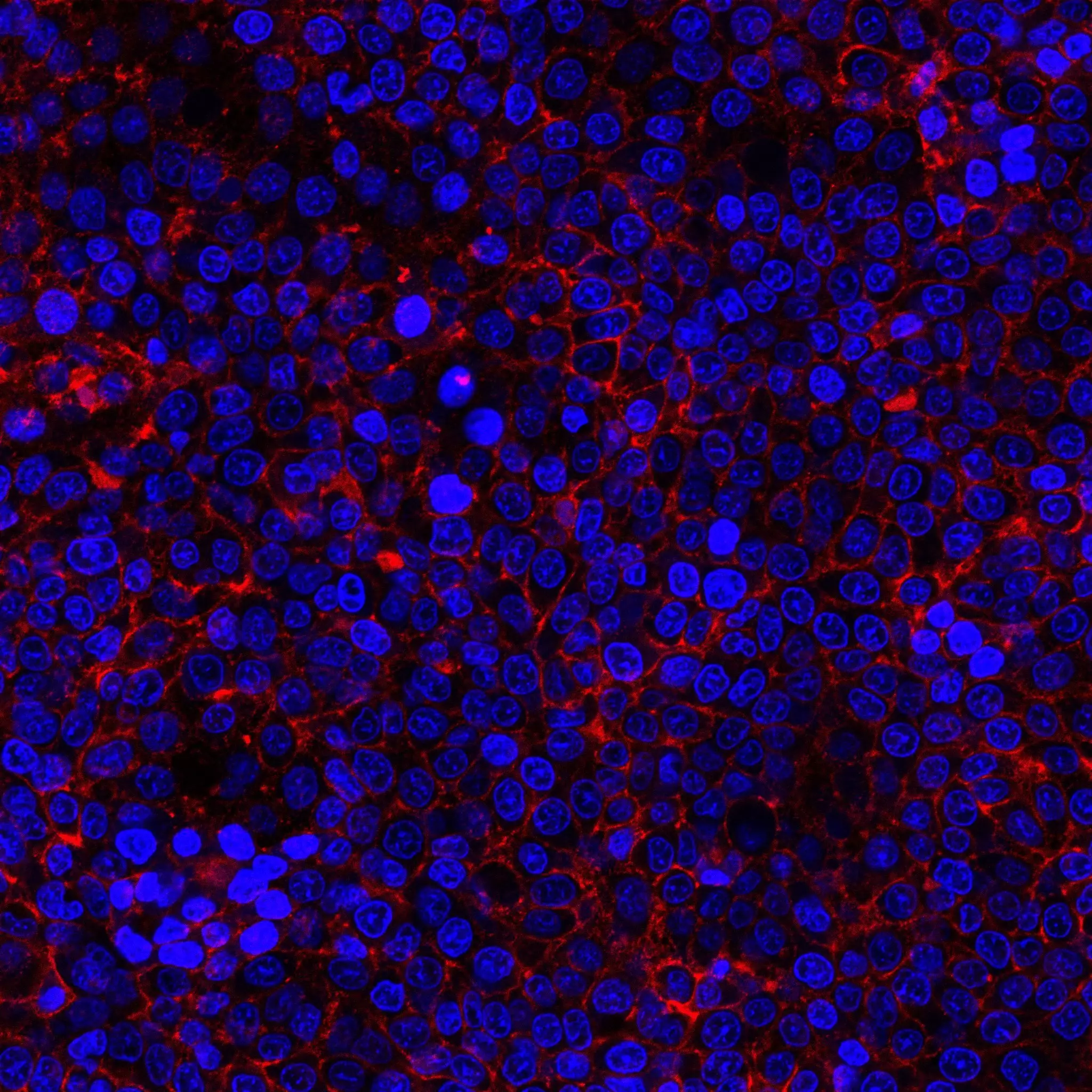 CD49c Antibody, anti-human, REAlease® | Miltenyi Biotec | USA