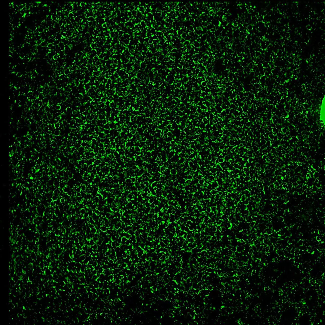 CD196 (CCR6) Antibody, anti-human, REAfinity™ | Recombinant antibodies ...