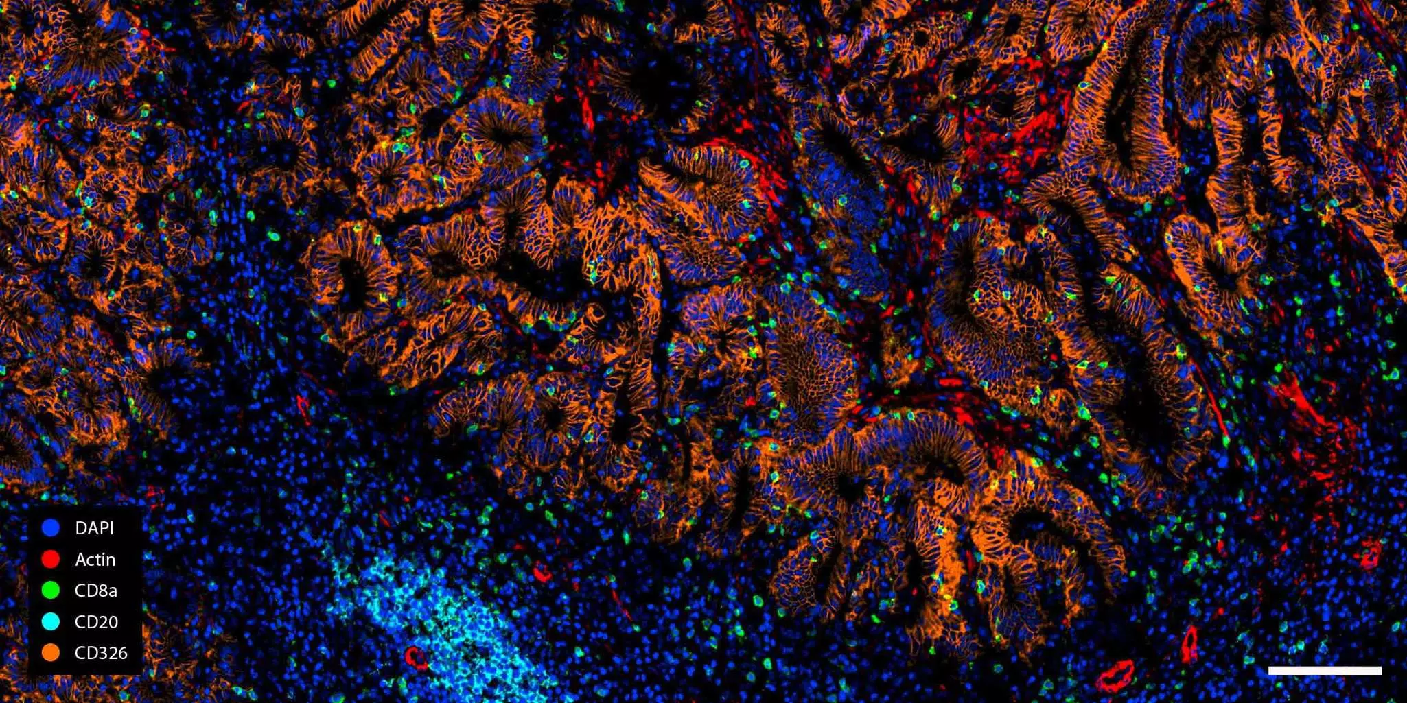 Predefined REAplex antibody kits for spatial mapping and multiplexing ...