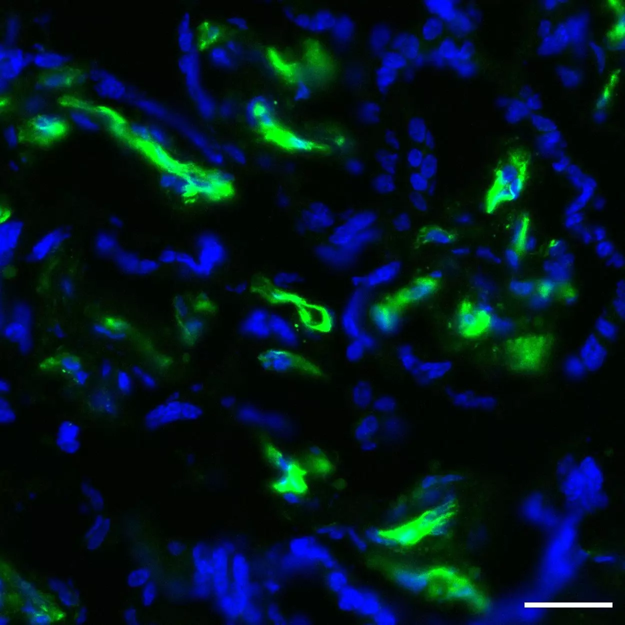 CD32 Antibody, anti-human, REAfinity™ | Miltenyi Biotec | USA