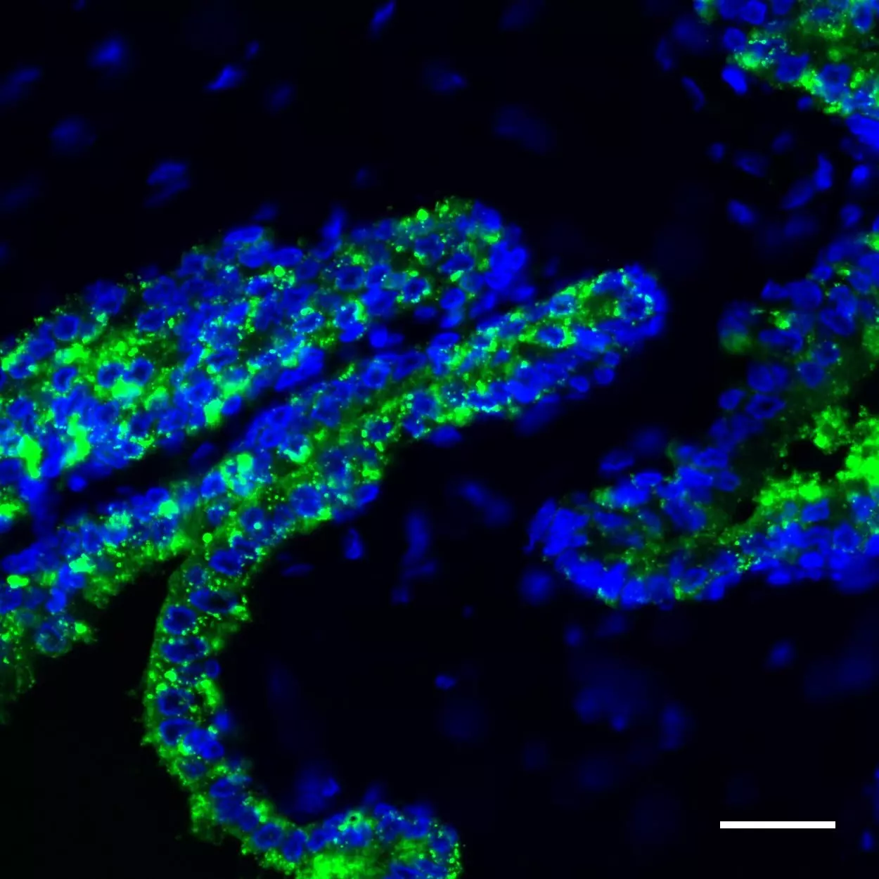 ACPP Antibody, anti-human, REAdye_lease™ | Miltenyi Biotec | India