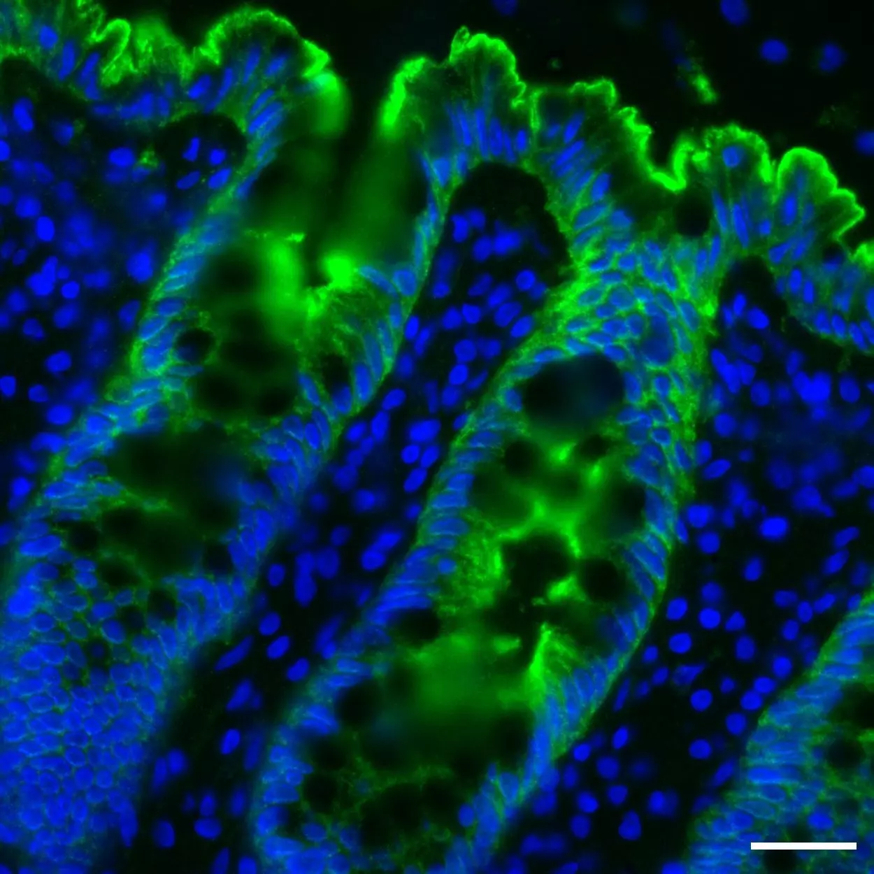 Villin Antibody, anti-human, REAdye_lease™ | Miltenyi Biotec | Great ...