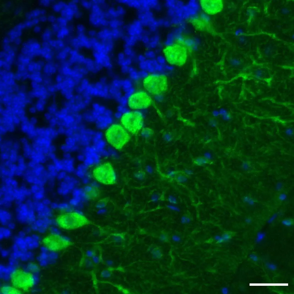 Parvalbumin Antibody, Anti-human/mouse/rat, REAfinity™ | Miltenyi ...