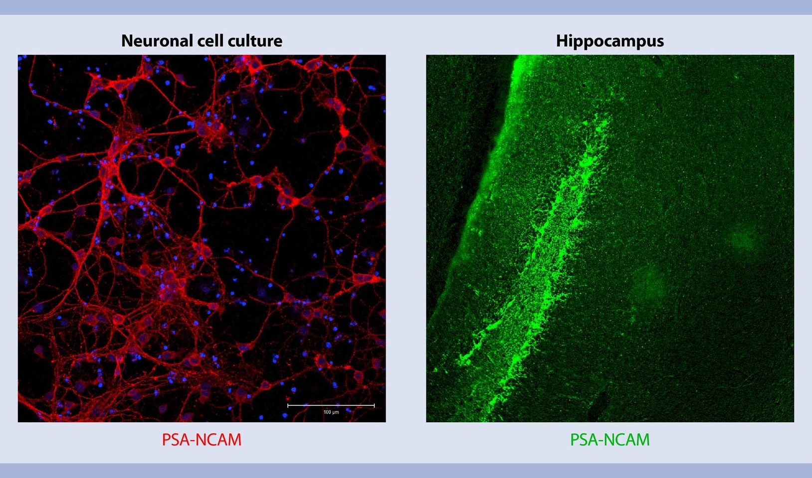 Isolation and cultivation of mouse neurons and neuronal precursor cells