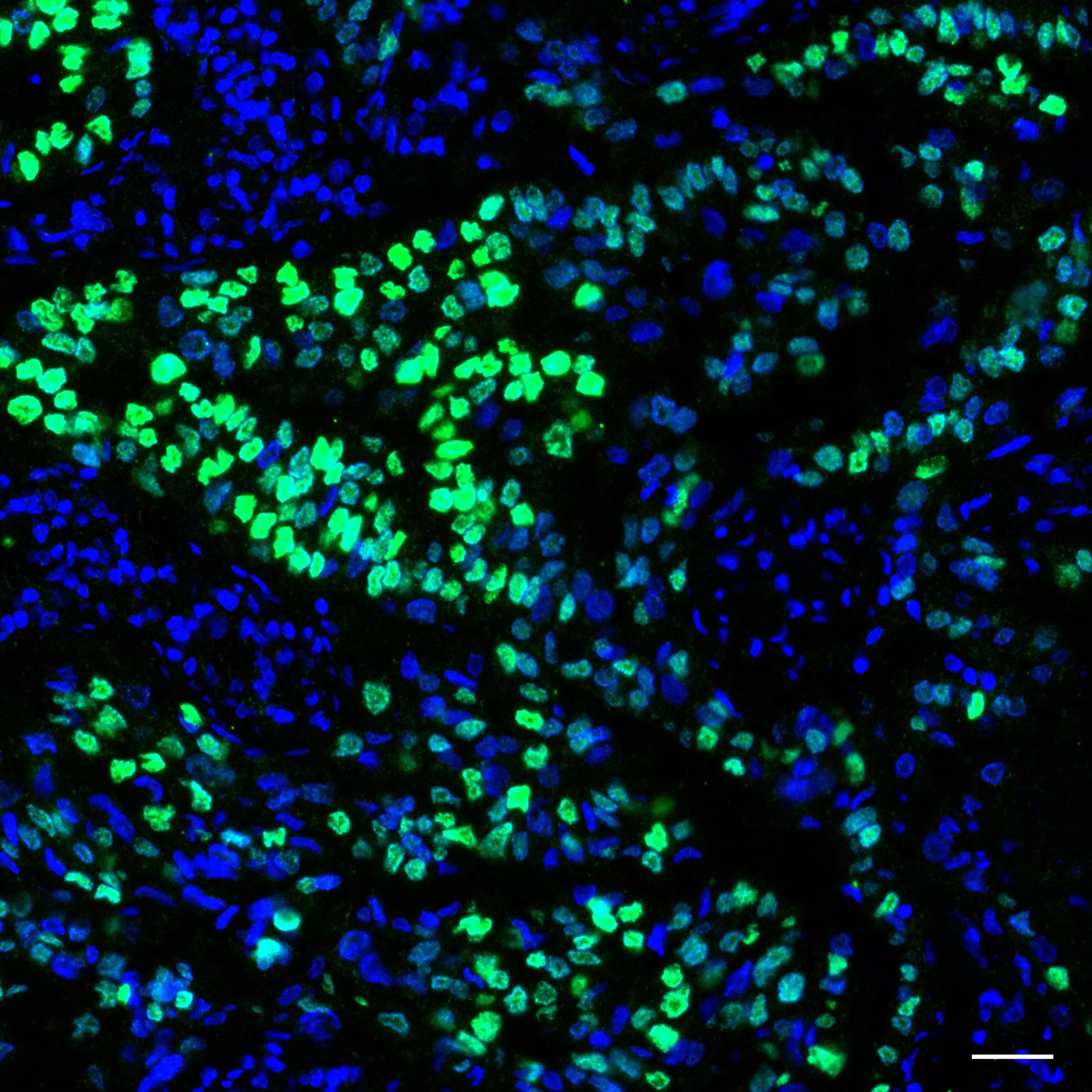 TTF-1 Antibody, anti-human/mouse, REAfinity™ | Miltenyi Biotec | USA