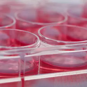 CD34 MicroBead Kit UltraPure, human | Miltenyi Biotec | USA