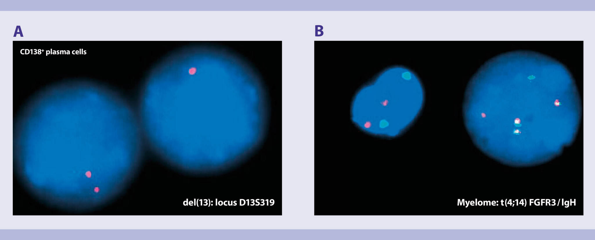 Multiple myeloma cell isolation Plasma cell isolation Miltenyi