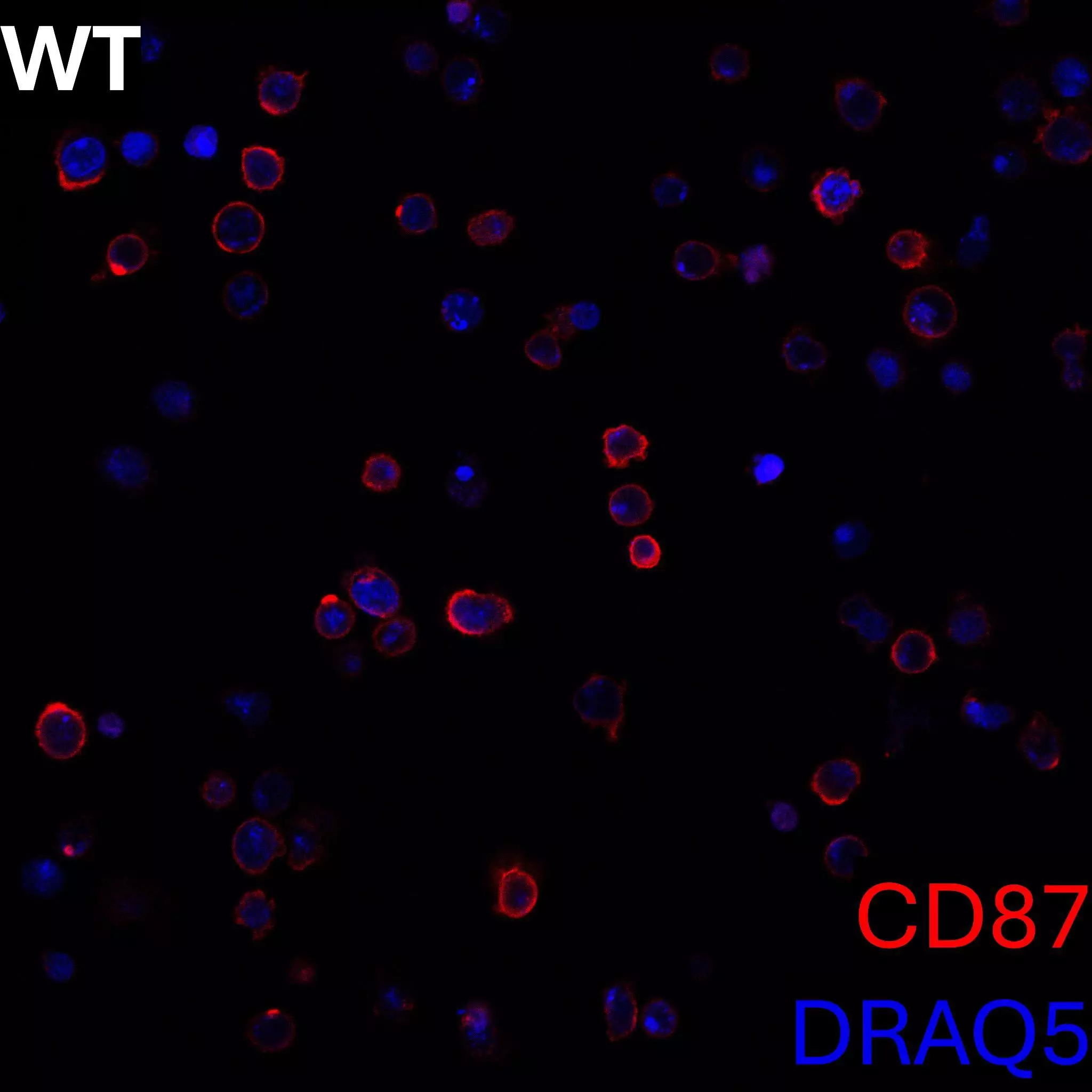 CD87 Antibody, anti-human, REAfinity™ | Miltenyi Biotec | USA