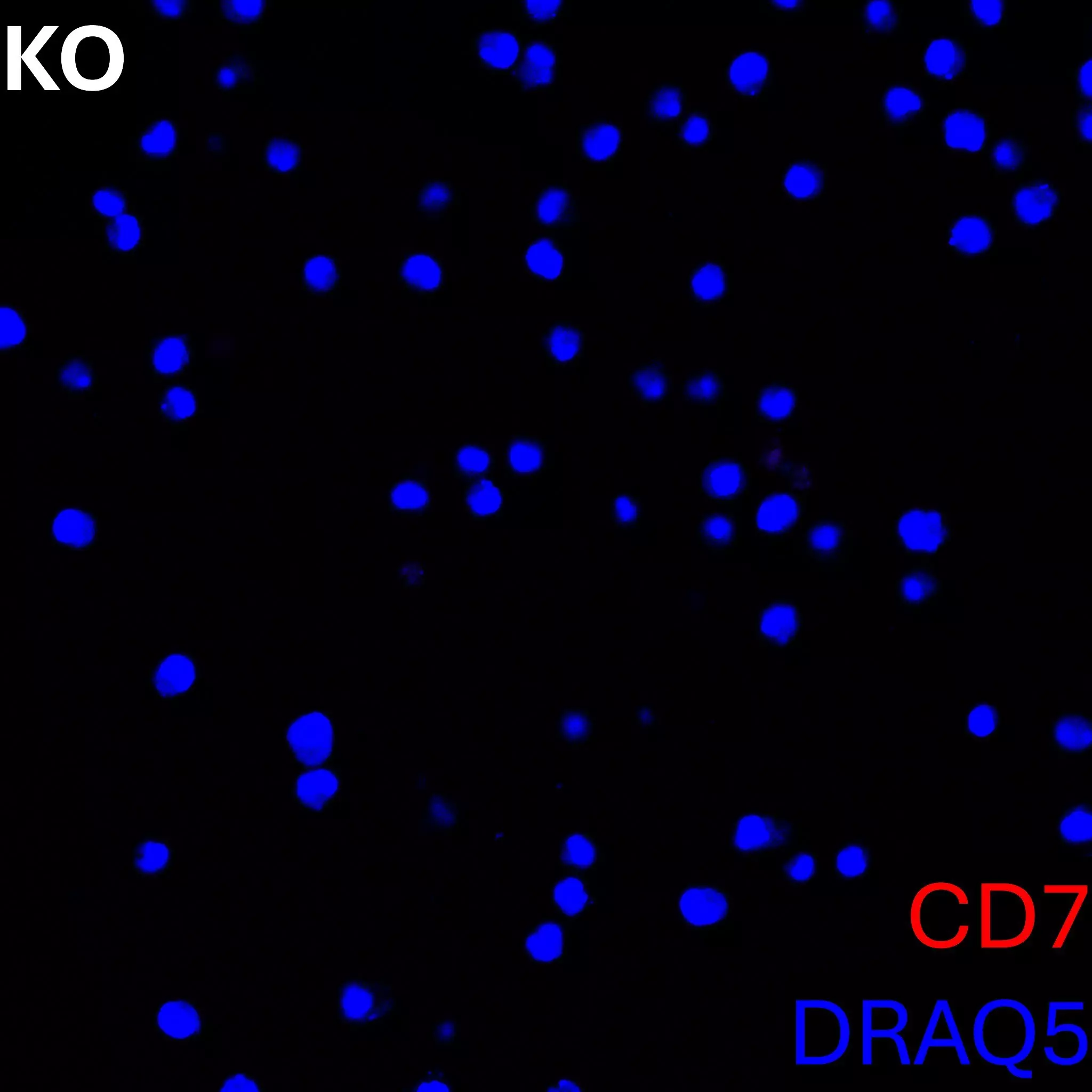 CD7 Antibody, anti-human, REAfinity™ | Miltenyi Biotec | Belgique