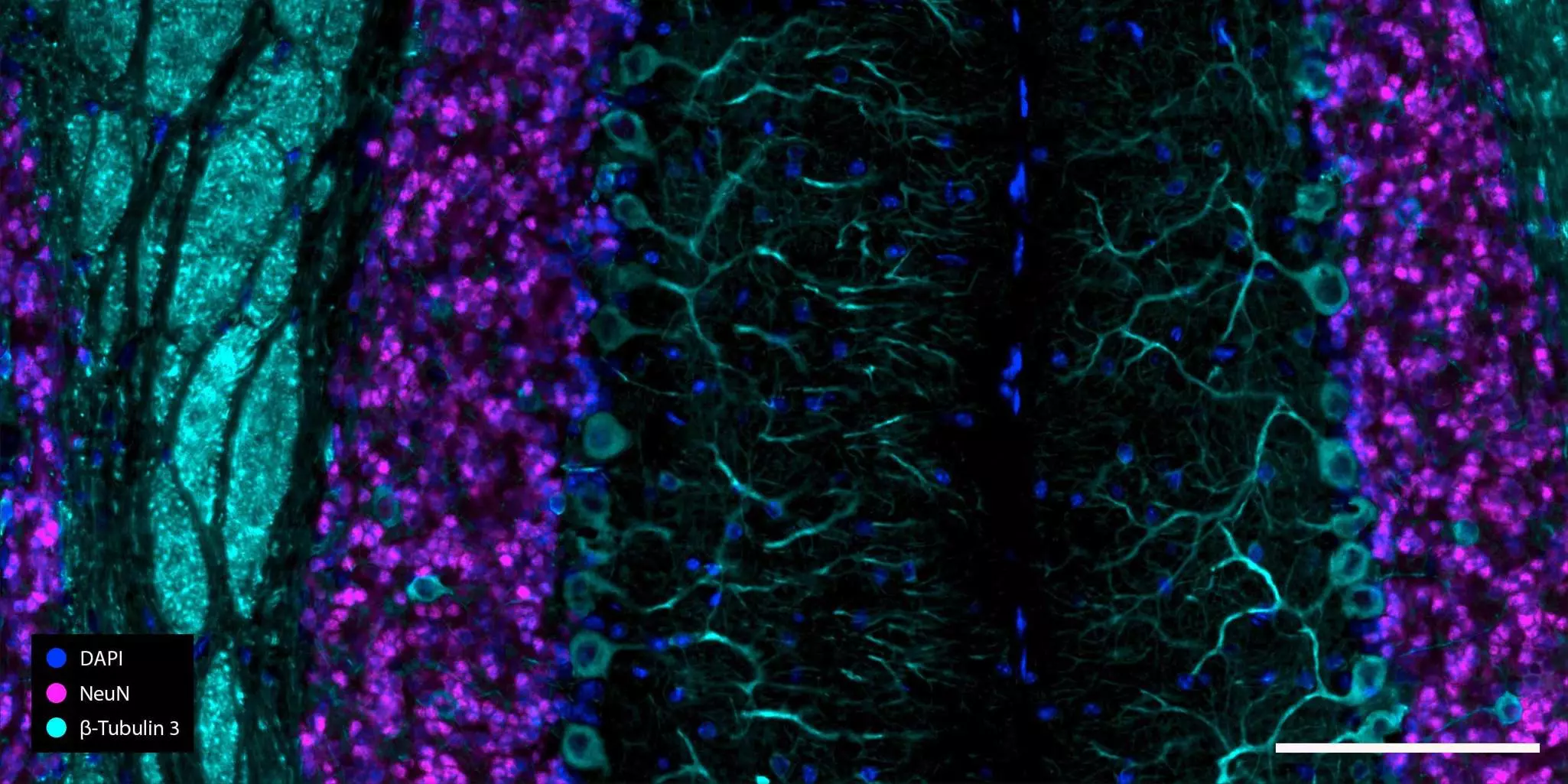 Predefined REAplex antibody kits for spatial mapping and multiplexing ...