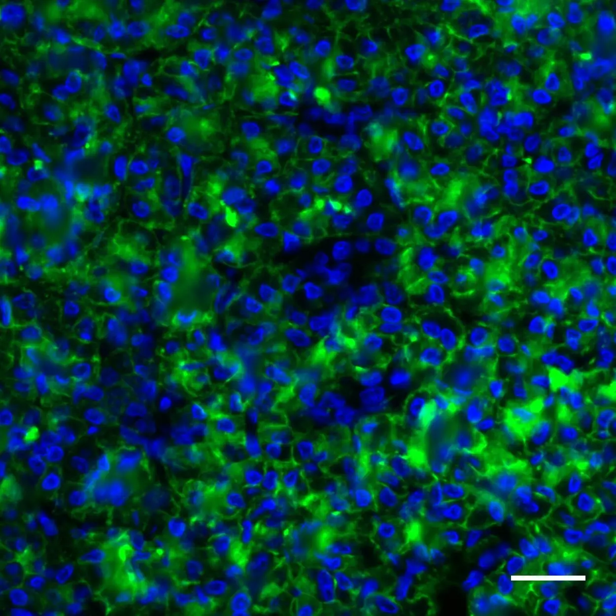 Gp2 Antibody, Anti-human, Readye Lease™ 