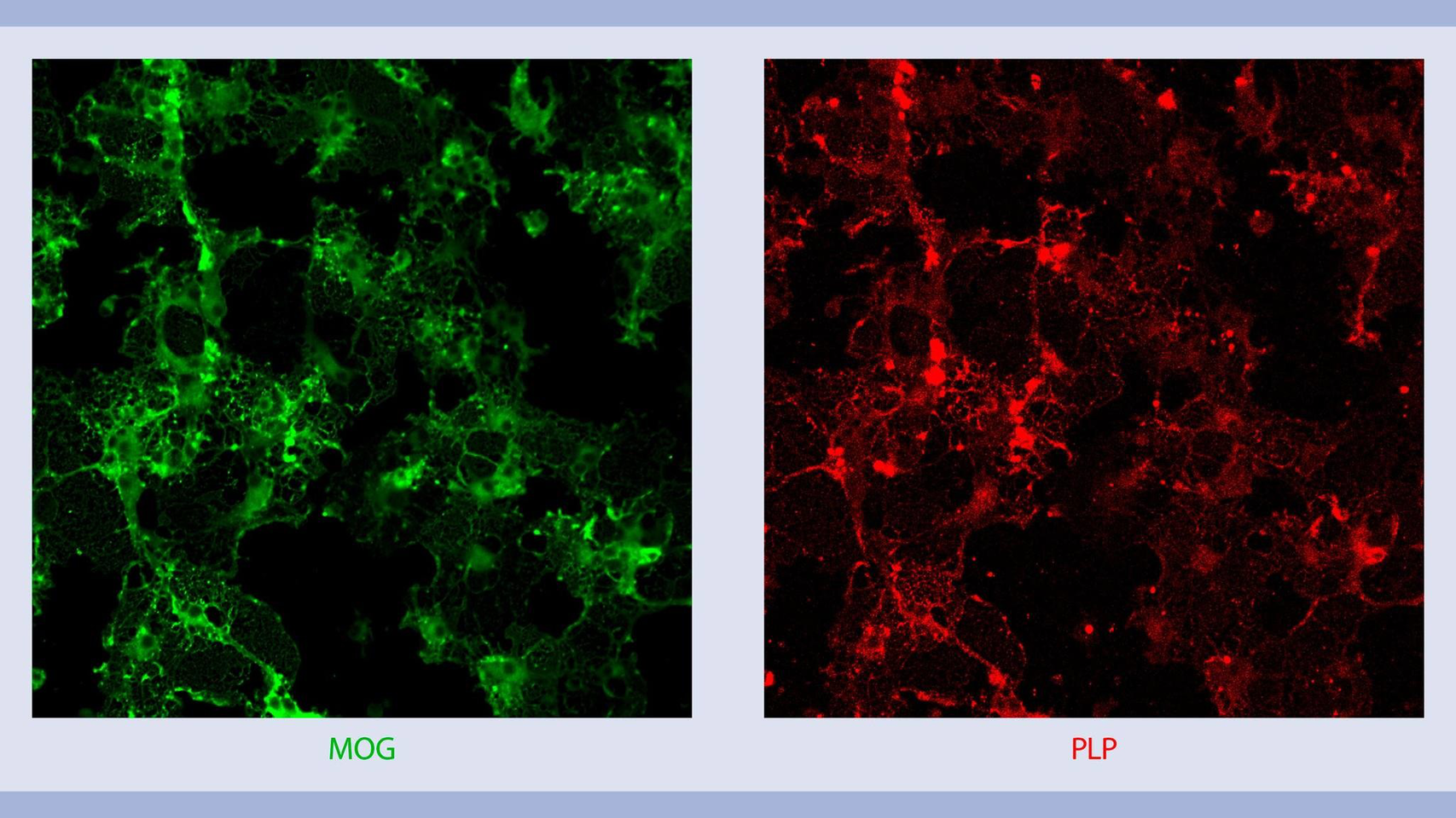 Isolation, Characterization, And Cultivation Of Oligodendrocytes ...