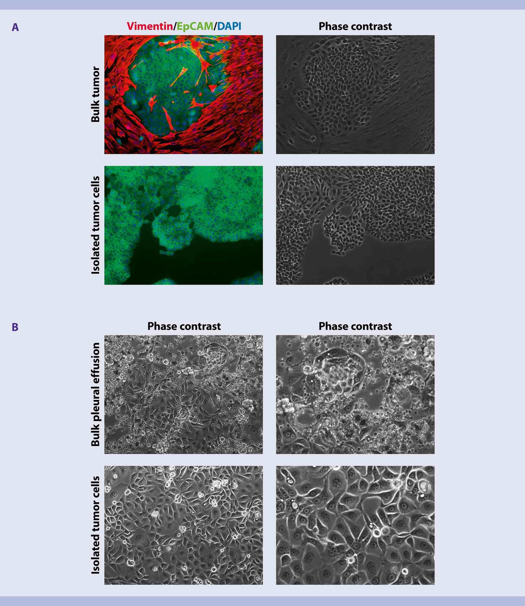 Initiation of human tumor cell culture from primary tumors Miltenyi