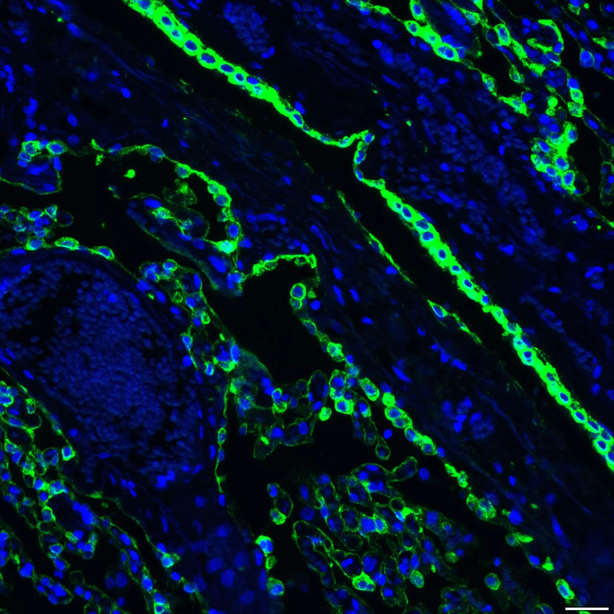 Cytokeratin LMW Antibody, anti-human, REAfinity™ | Miltenyi Biotec