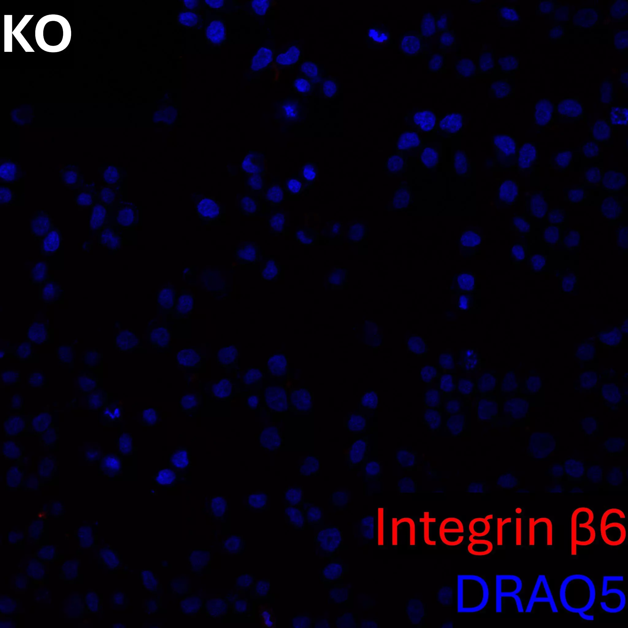 Integrin β6 Antibody, anti-human, REAfinity™ | Miltenyi Biotec | USA
