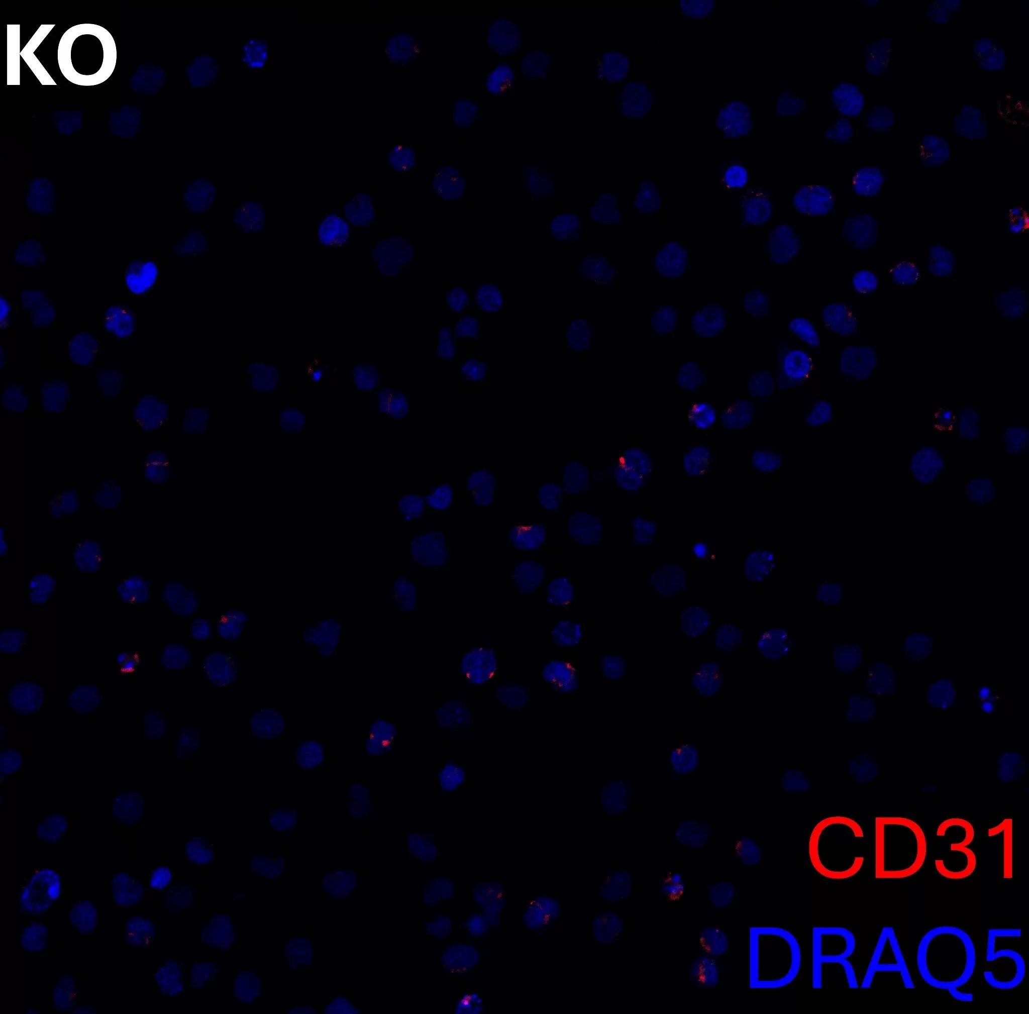 CD31 Antibody, anti-human, REAlease® | Miltenyi Biotec | 中国