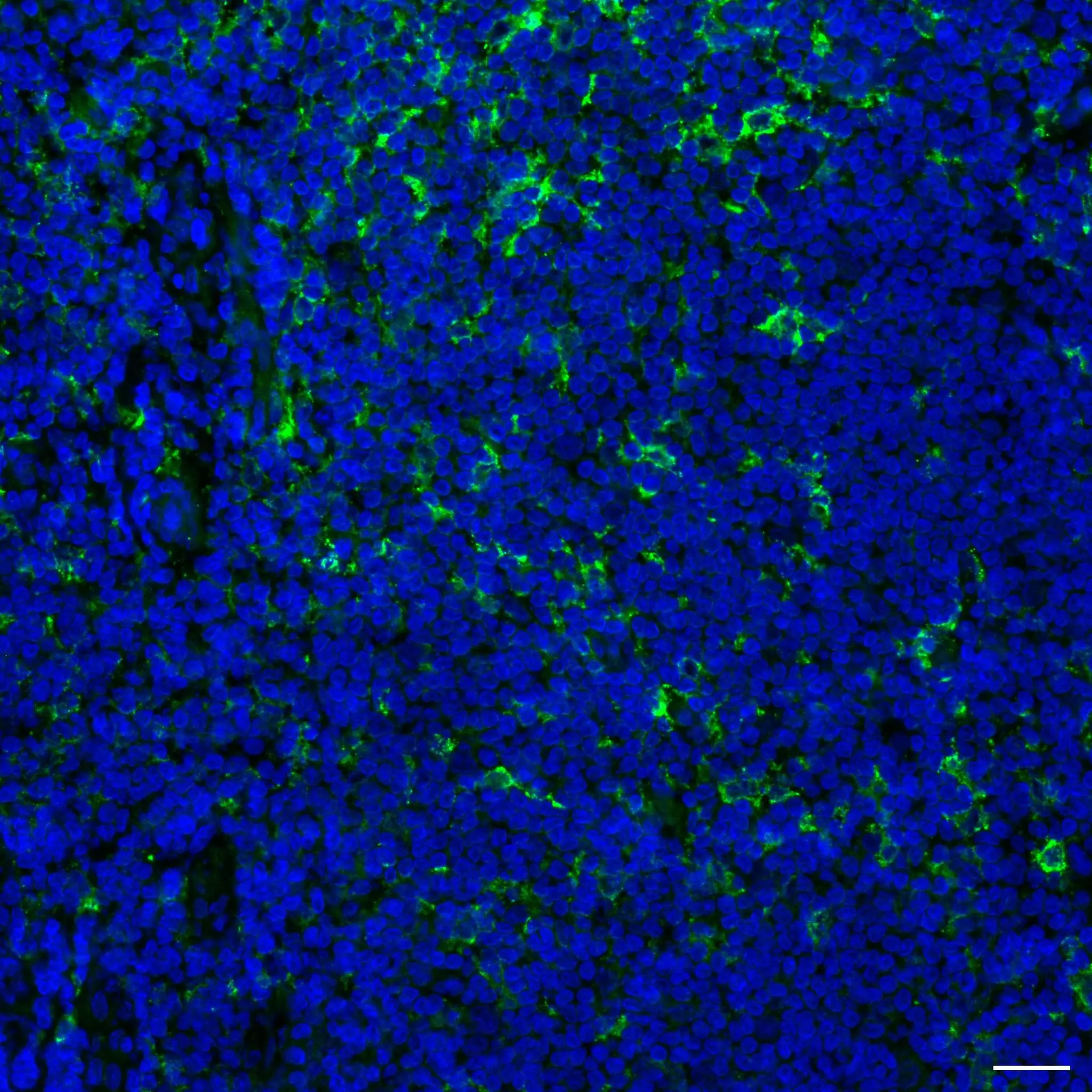 CD11c Antibody, anti-human, REAfinity™ | Miltenyi Biotec | Danmark
