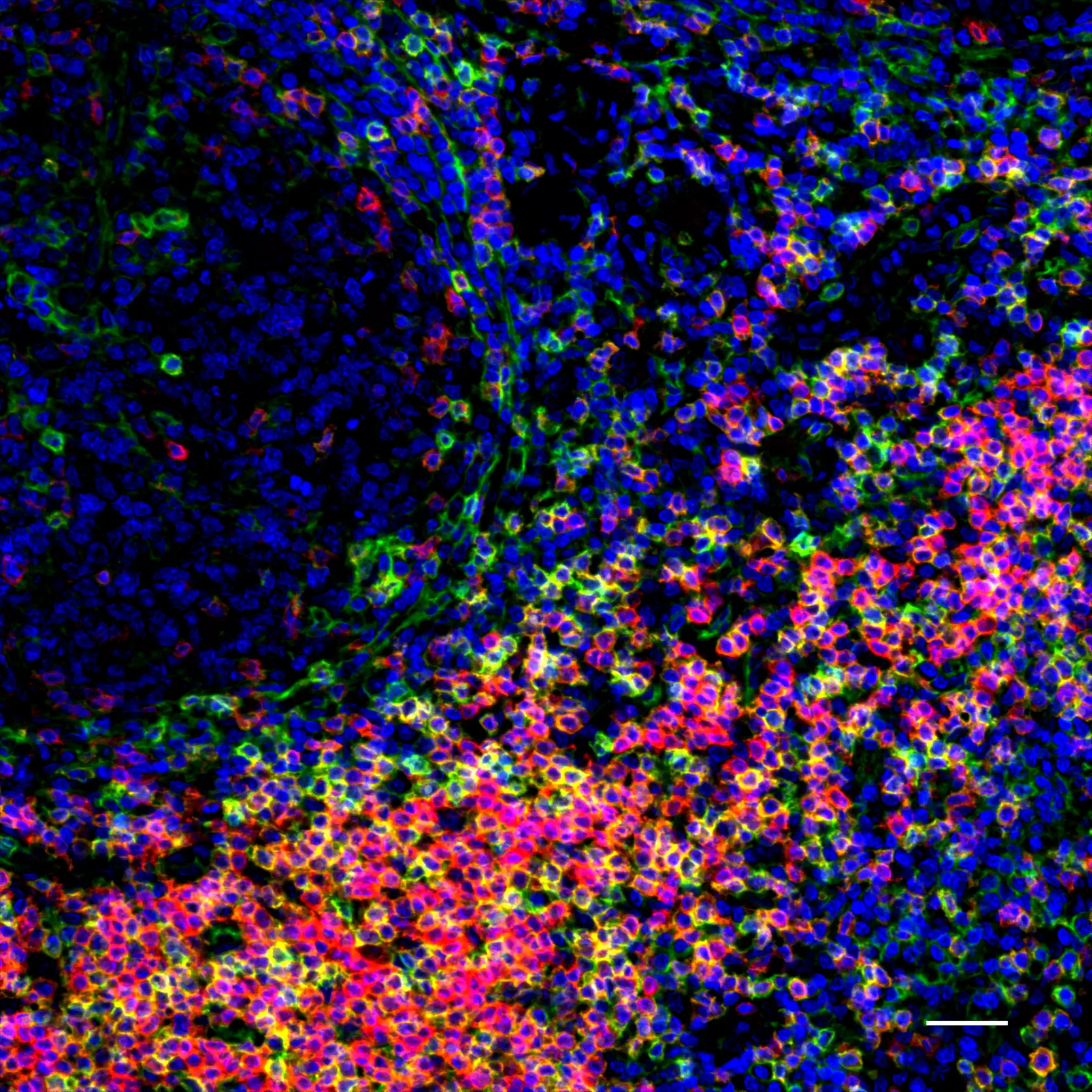 CD99 Antibody, anti-human, REAfinity™ | Miltenyi Biotec | USA