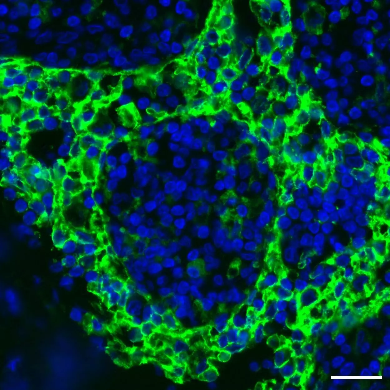 CD209 (DC-SIGN) Antibody, anti-human, REAdye_lease™ | Miltenyi Biotec | USA