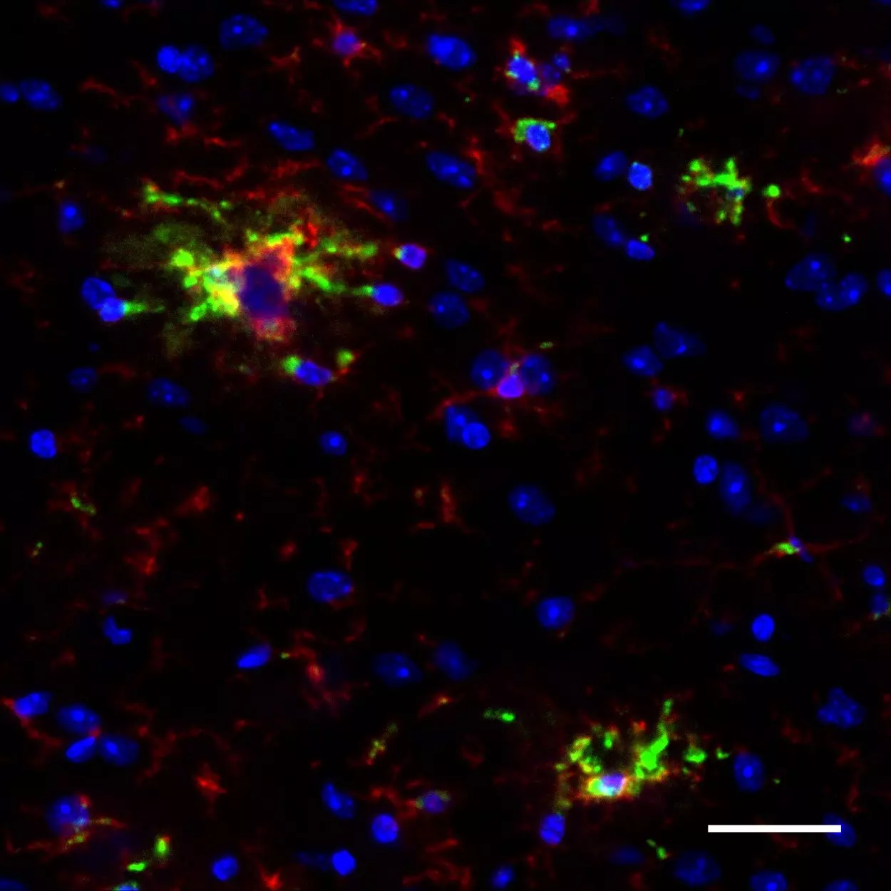 DAIYAMOND 11 羊膜酵素 CD68 Antibody, anti-mouse, REAfinity™ | Miltenyi Biotec | Deutschland