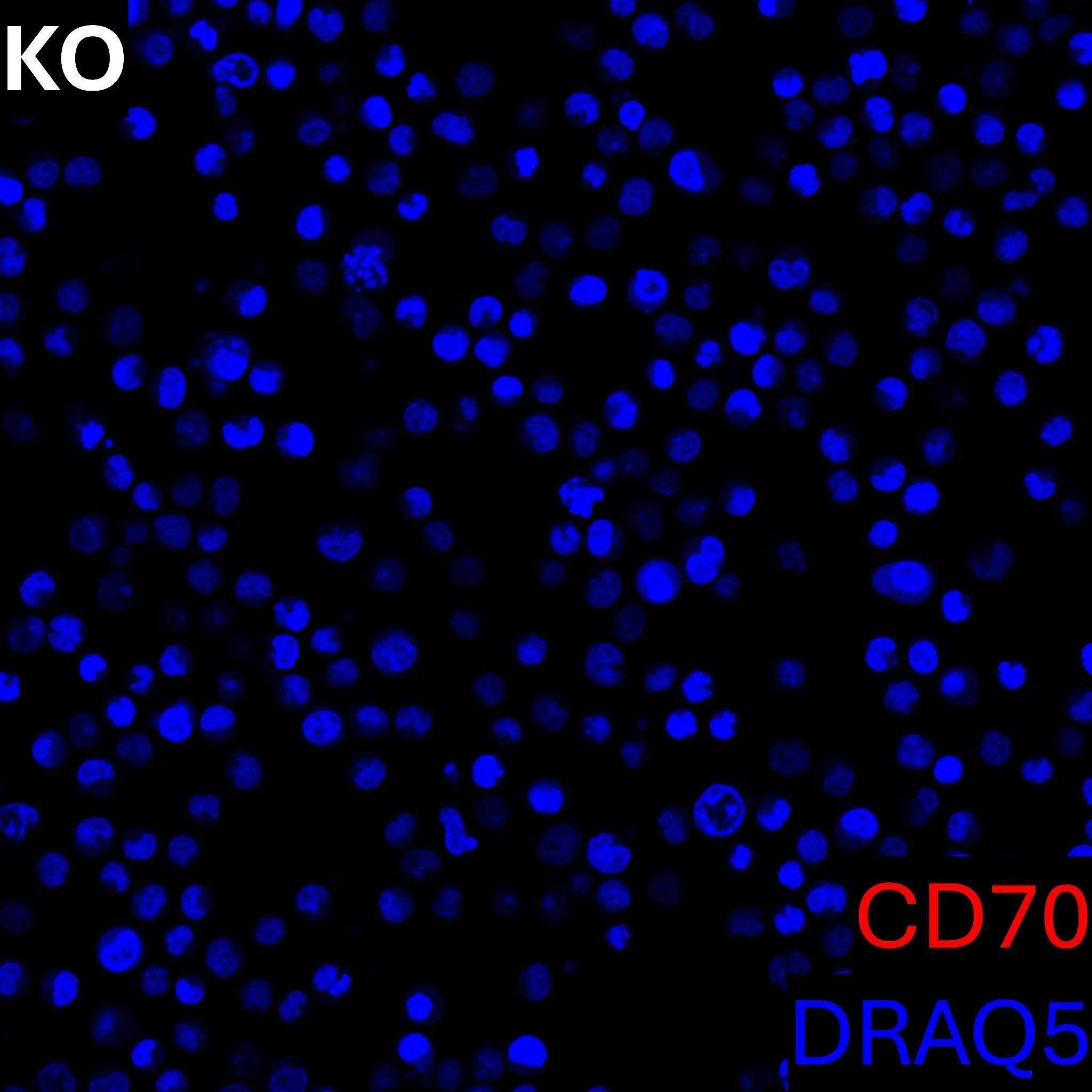 CD70 Antibody, anti-human, REAfinity™ | Miltenyi Biotec | India