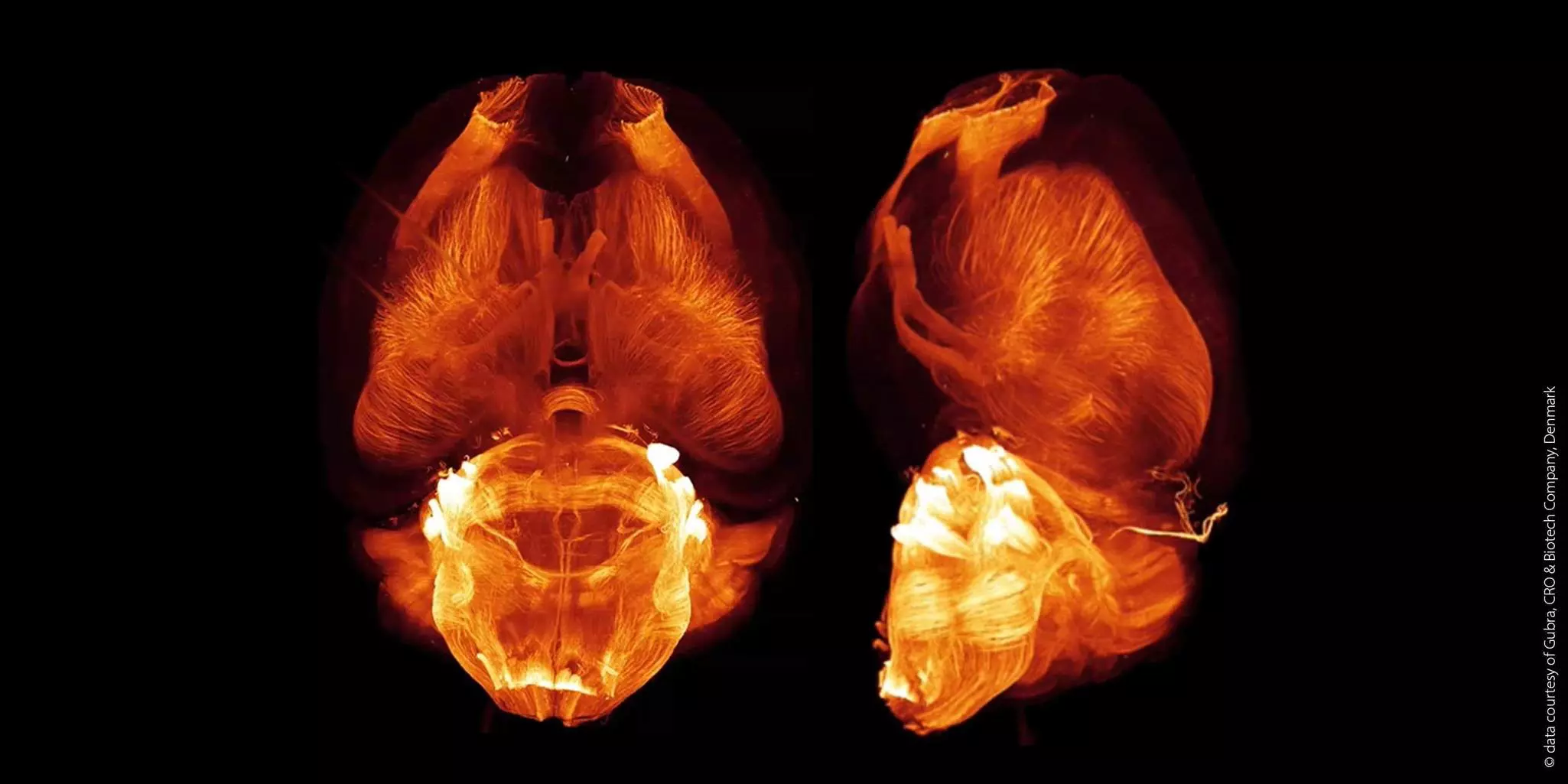 CD4+ Central Memory T Cell Isolation Kit, human | Miltenyi Biotec