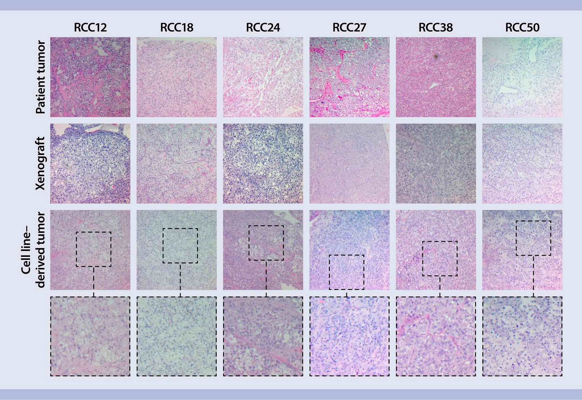 Initiation of human tumor cell culture from primary tumors | Miltenyi ...