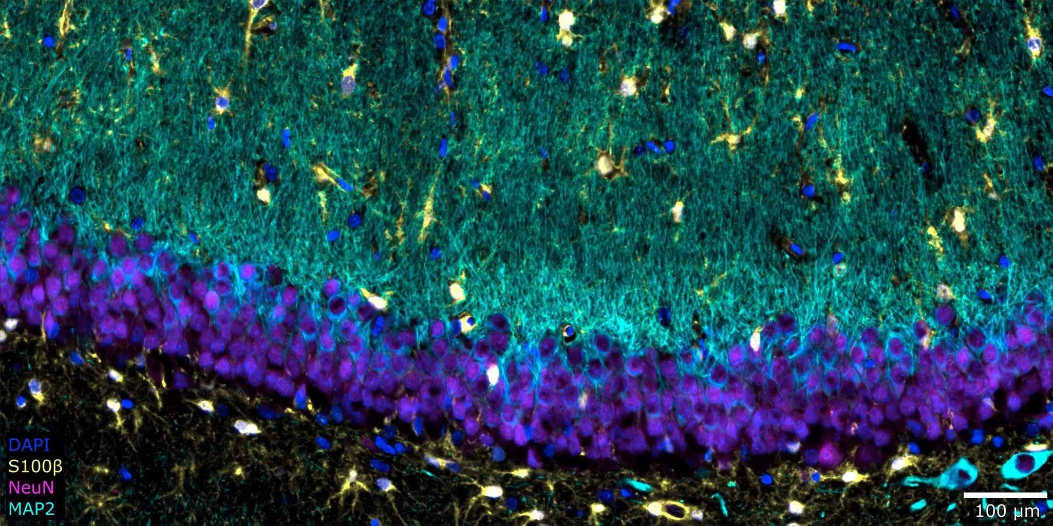 Application protocol | MACSima imaging | REAplex Neuro Core | spatial ...