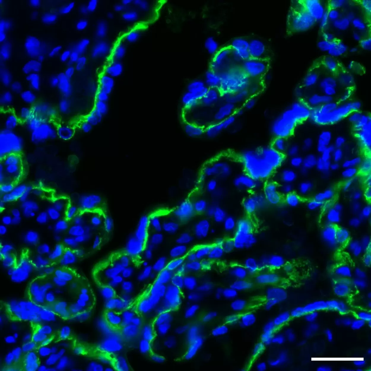 CD49f (Integrin α6) Antibody, anti-human, REAfinity™ | Miltenyi Biotec ...