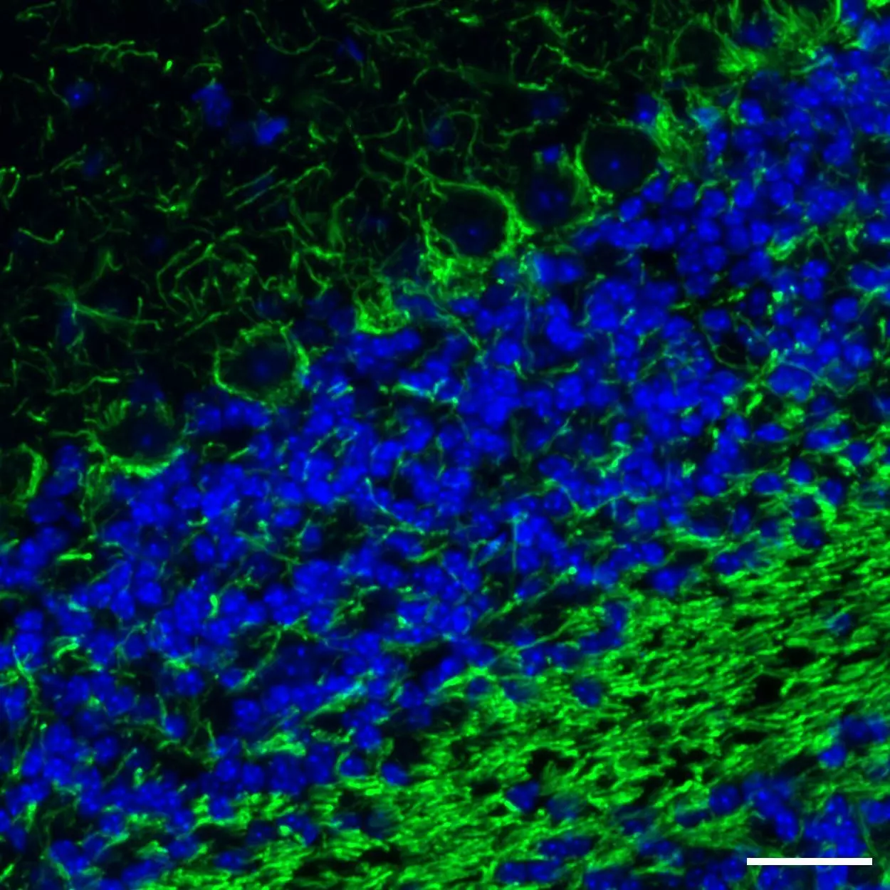 Neurofilament Antibody, anti-human/mouse, REAfinity™ | Miltenyi