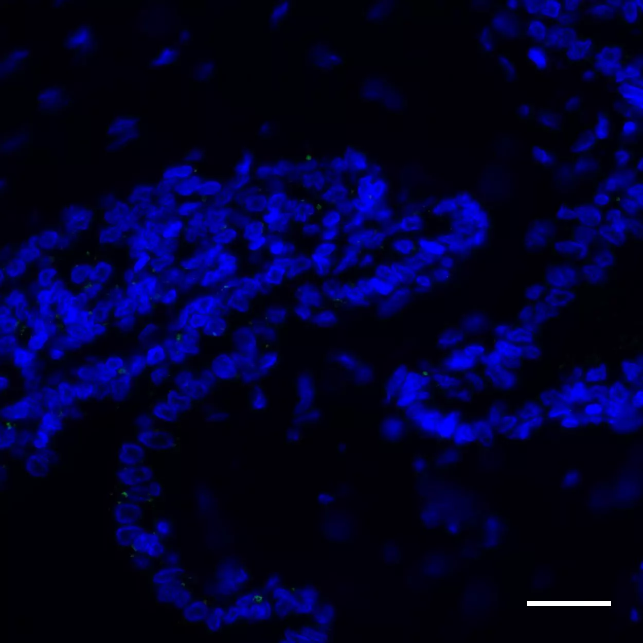 ACPP Antibody, anti-human, REAdye_lease™ | Miltenyi Biotec | India