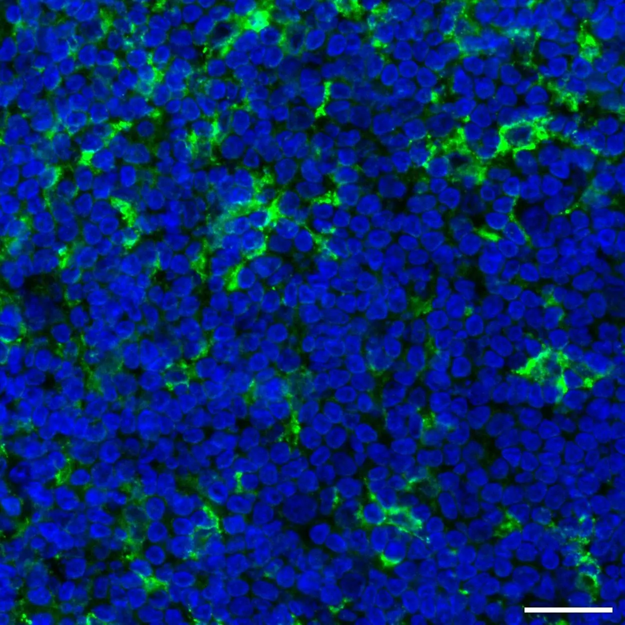 CD11c Antibody, anti-human, REAfinity™ | Miltenyi Biotec | Danmark