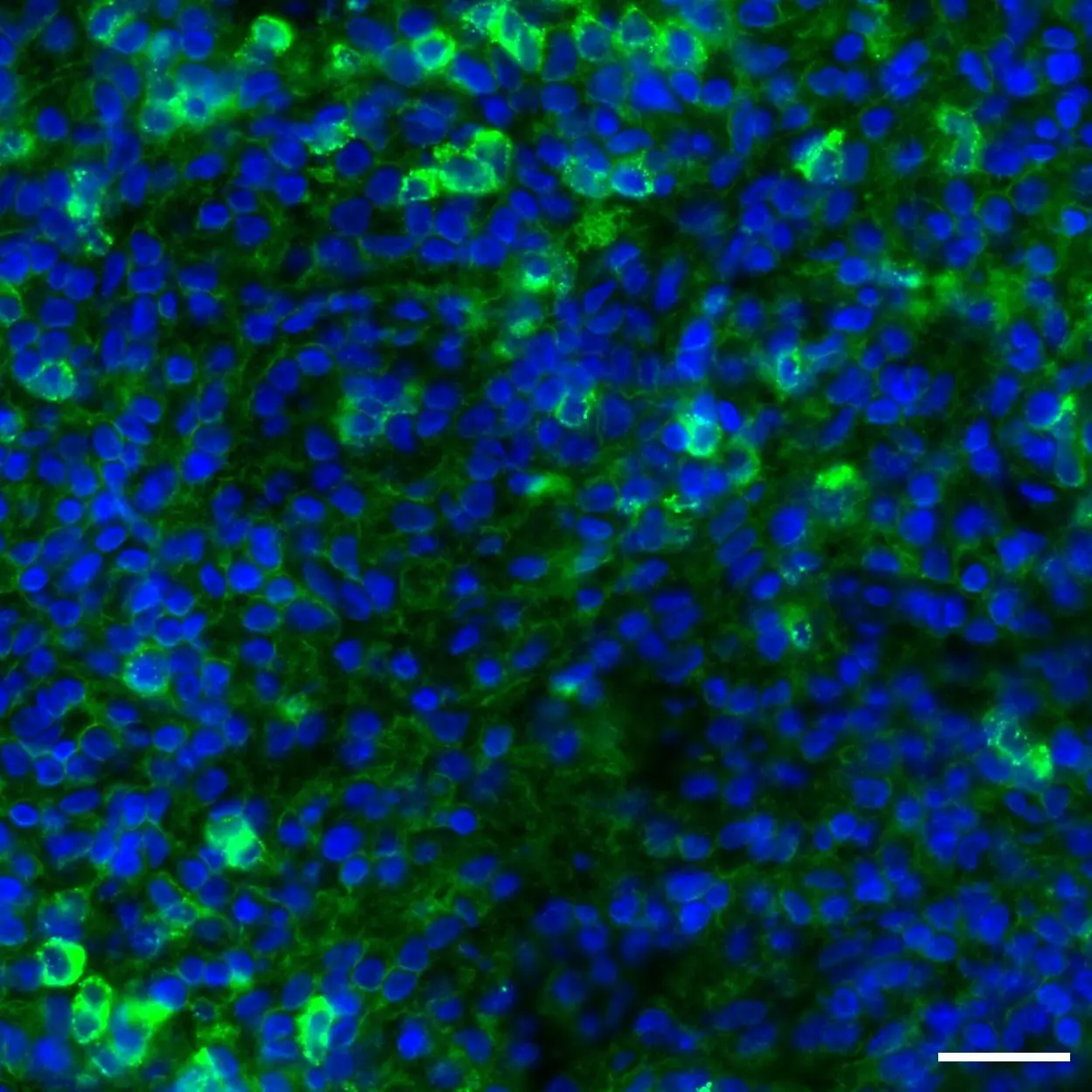 CD66b Antibody, anti-human, REAdye_lease™ | Miltenyi Biotec | Deutschland