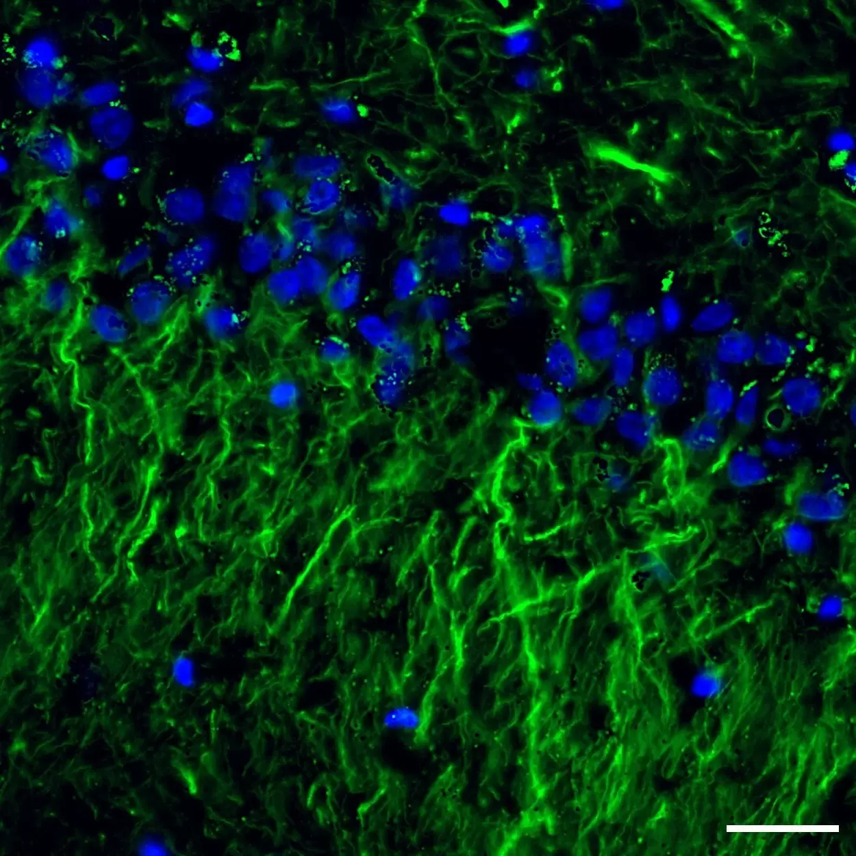 MAP2 Antibody, anti-human, REAdye_lease™ | Miltenyi Biotec | USA