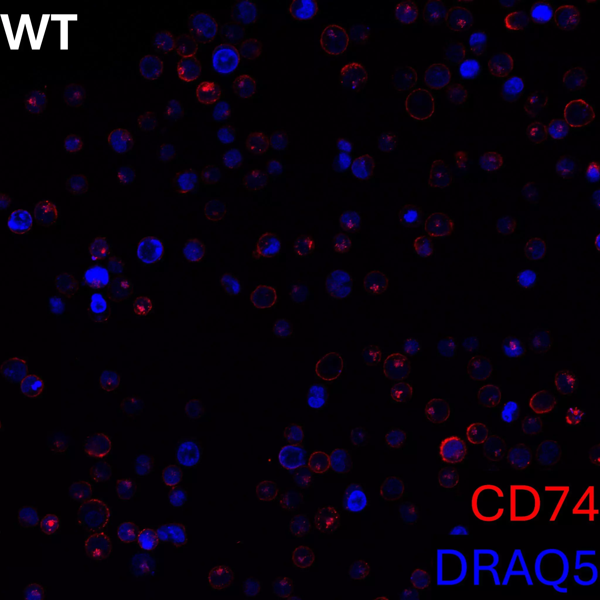 CD74 Antibody, anti-human, REAfinity™ | Miltenyi Biotec | USA