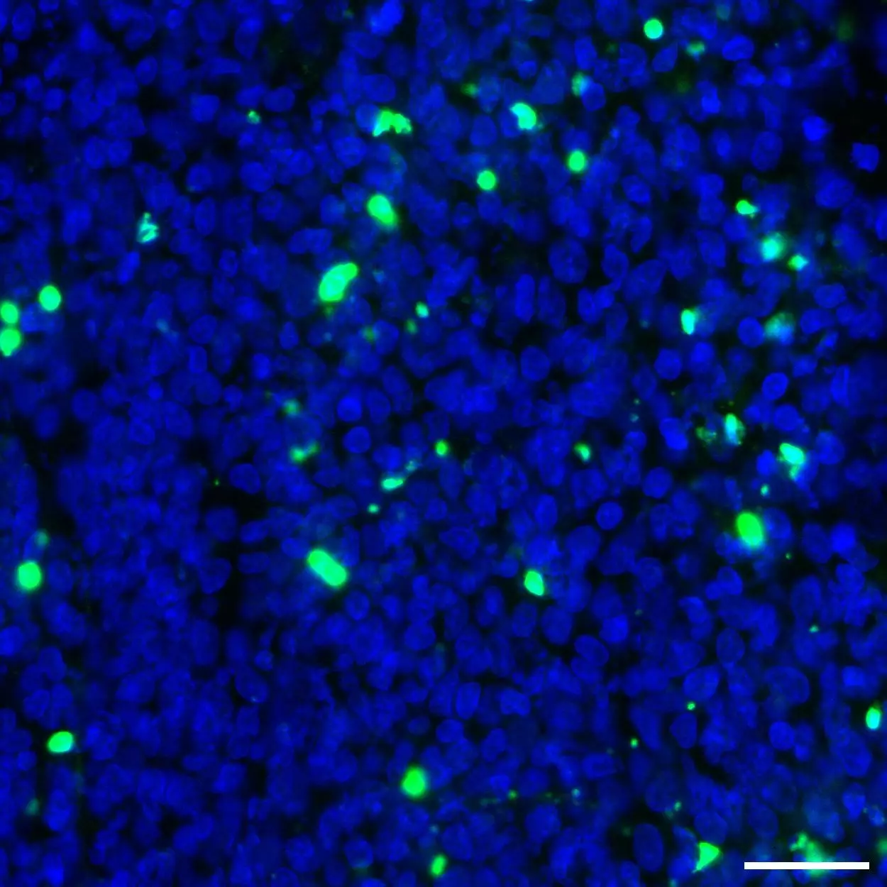 Cleaved PARP1 Antibody, anti-human, REAfinity™ | Miltenyi Biotec | Ireland
