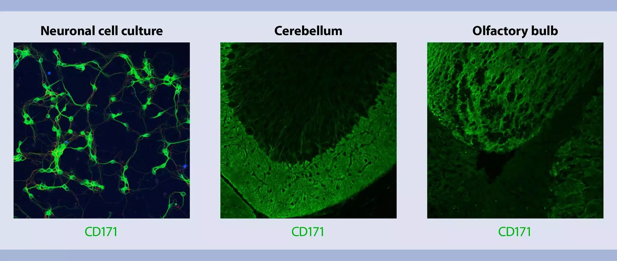 Isolation and cultivation of mouse neurons | Workflow | Miltenyi Biotec ...