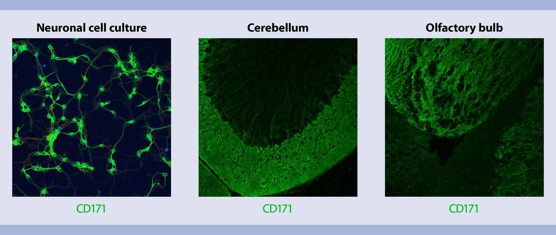 Isolation and cultivation of mouse neurons and neuronal precursor cells