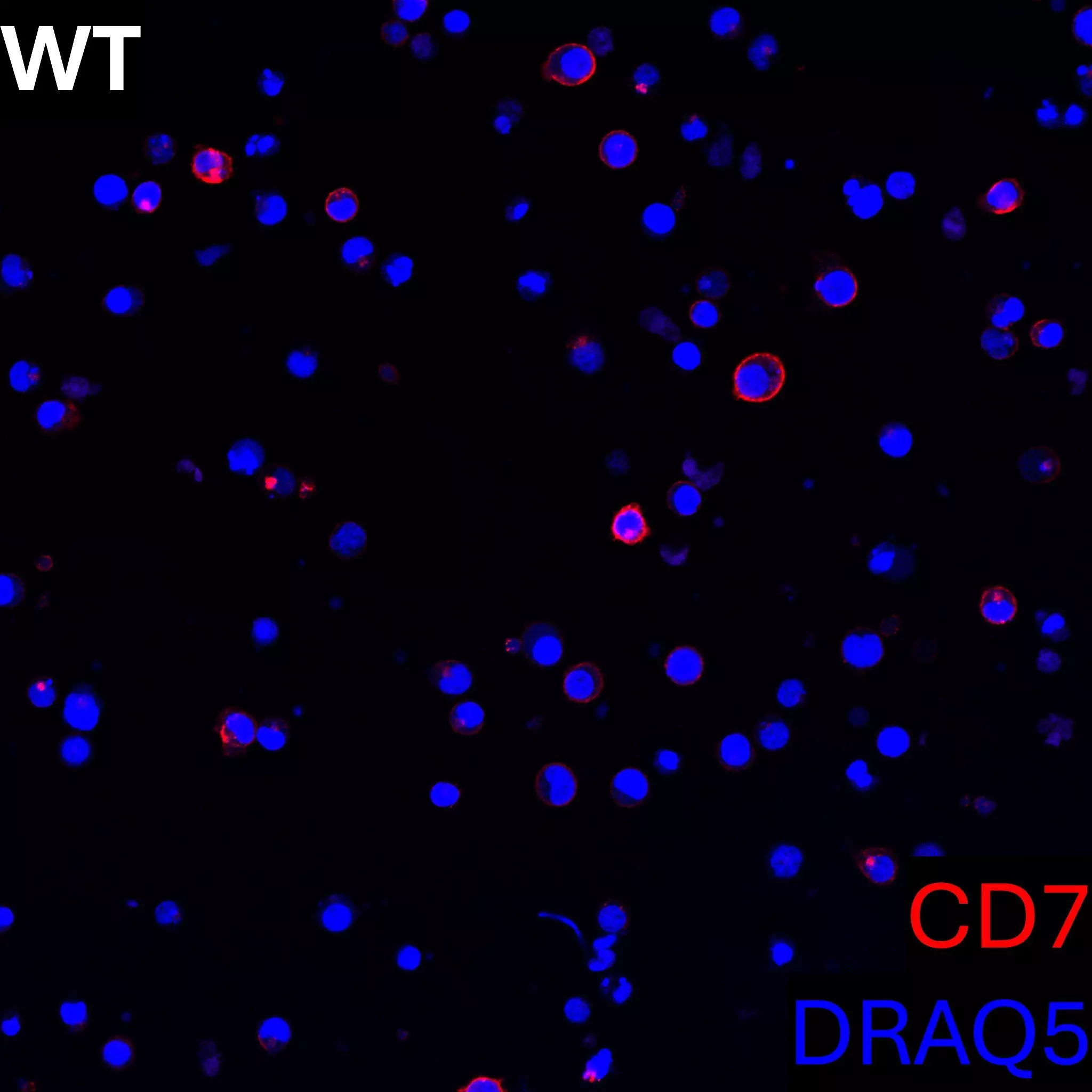 CD7 Antibody, anti-human, REAfinity™ | Miltenyi Biotec | Belgique
