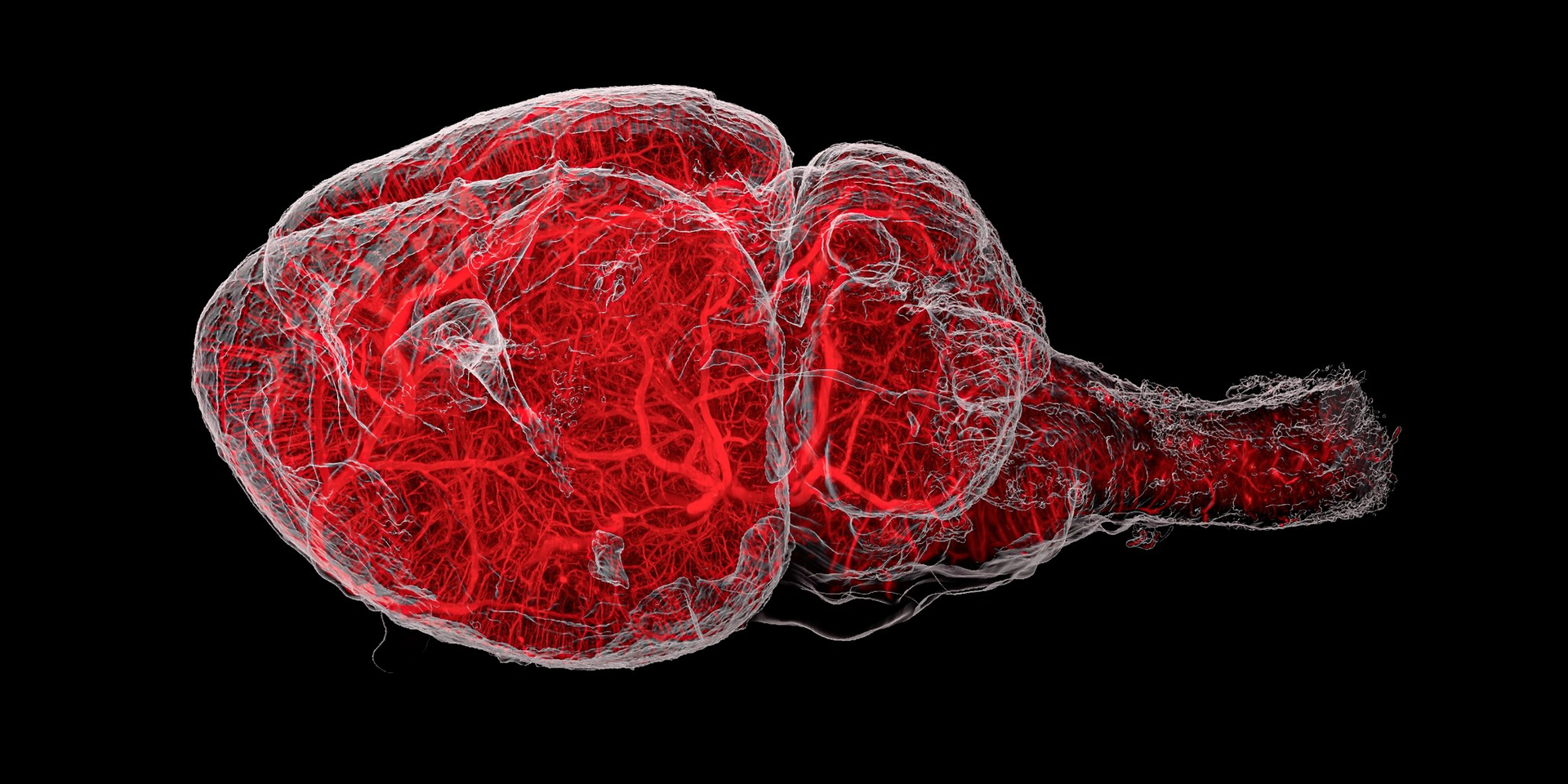 Light sheet microscopy UltraMicroscope Platform Visualizing complex